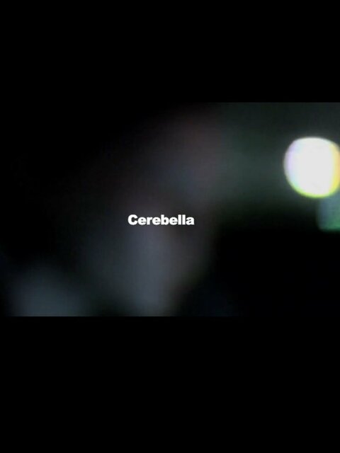Cerebella