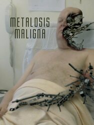 Metalosis Maligna