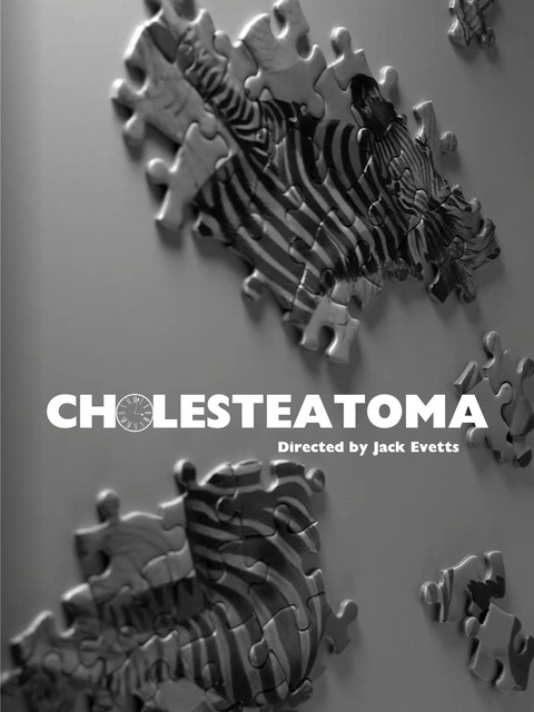 Cholesteatoma