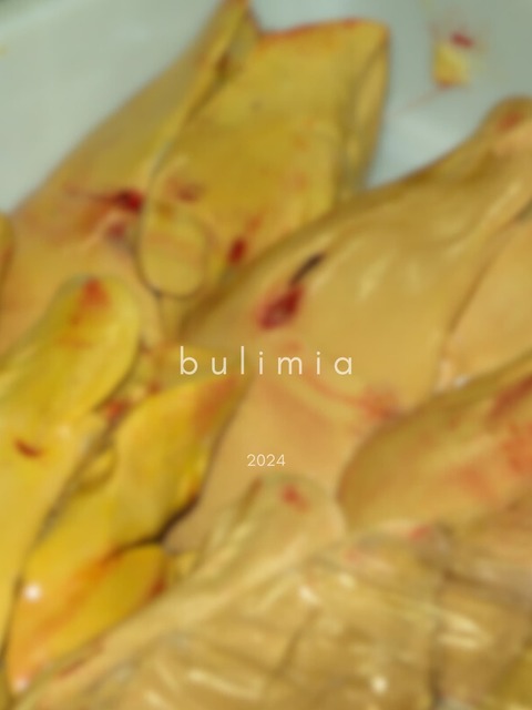 Bulimia