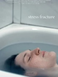 Stress Facture